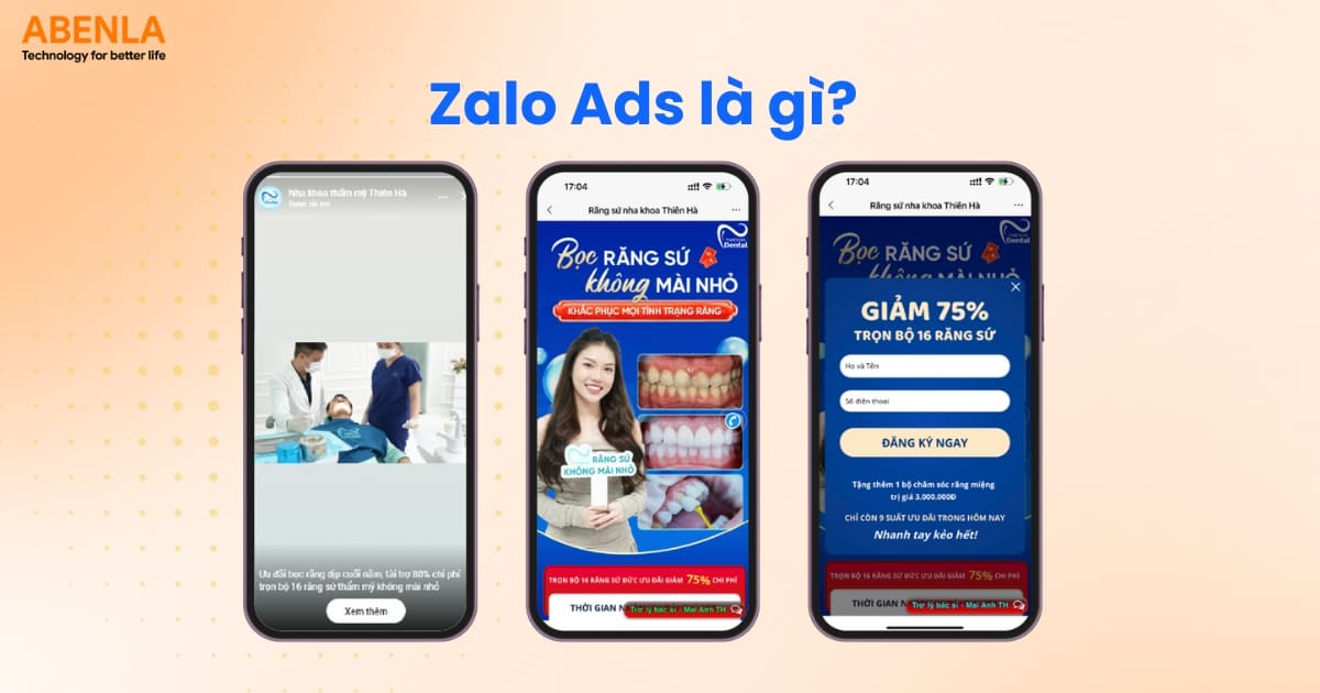 Tìm hiểu Zalo Ads là gì?